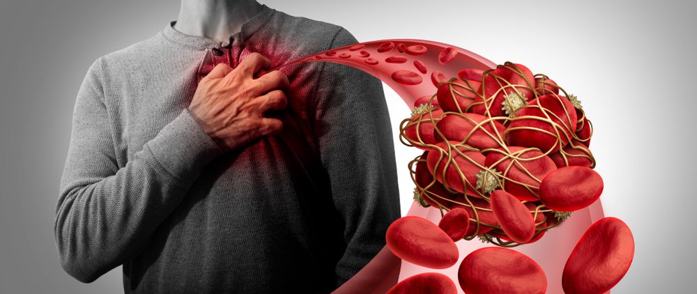 Heart Disease, flu complications