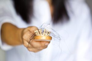 diseases that cause severe hair loss