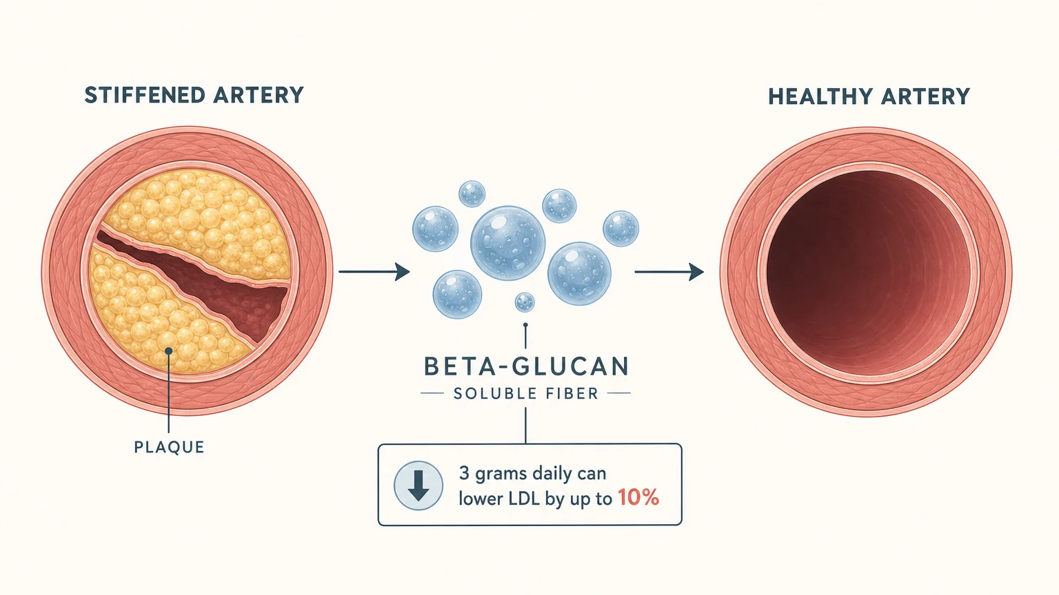 A diagram showing how soluble fiber from oats helps clear plaque from arteries to improve heart health.