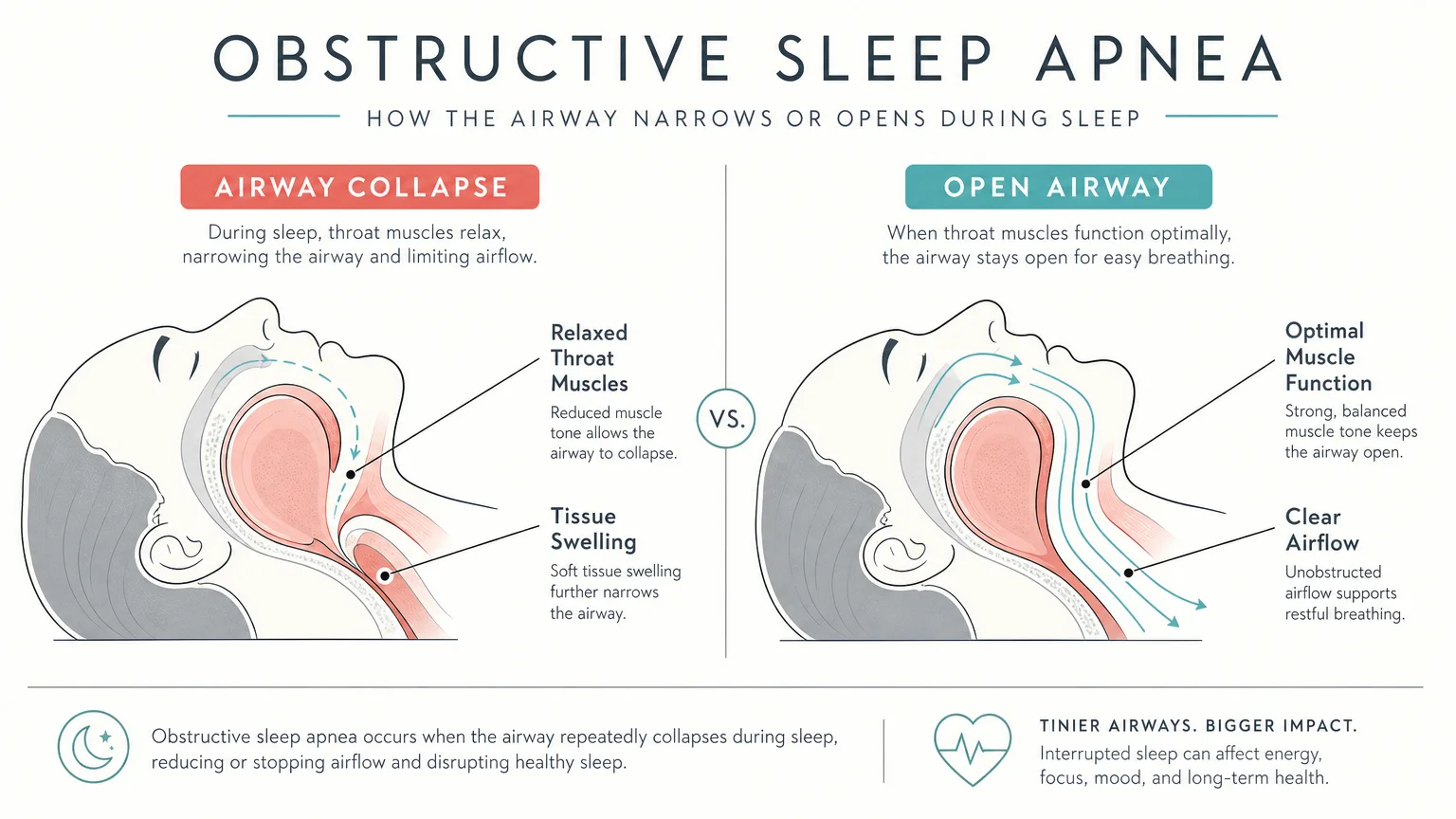 Minimalist diagram comparing an obstructed airway with tissue swelling to a clear, open airway with optimal muscle function.